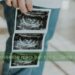 femme tient échographie de son bébé