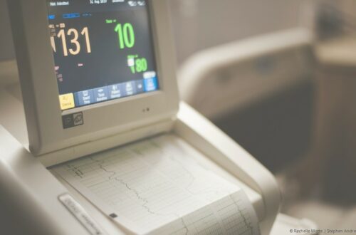 monitoring accouchement